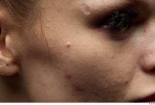 HD Face Skin Alison cheek eye face scar skin pores…